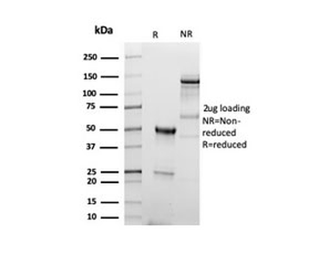 Recombinant CD5 Antibody