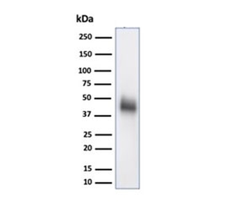 CD48 Antibody (Pan Leukocyte Marker)