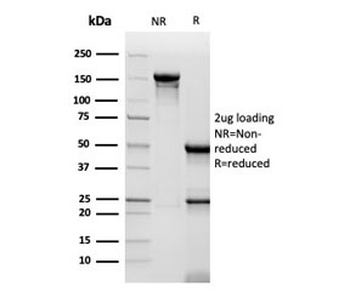 CD48 Antibody (Pan Leukocyte Marker)