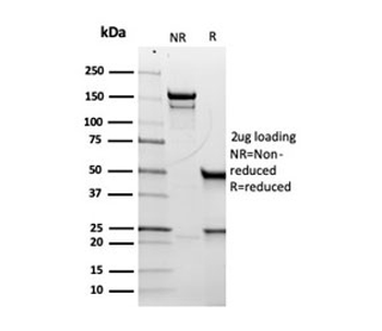 Recombinant CD5 Antibody
