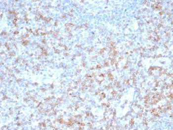 Recombinant CD5 Antibody