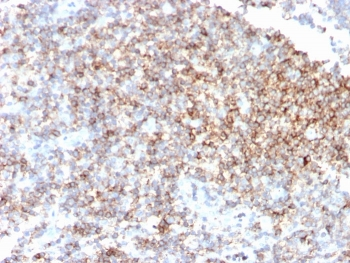 CD48 Antibody (Pan Leukocyte Marker)