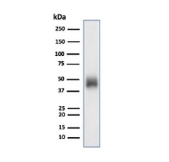 CD48 Antibody (Pan Leukocyte Marker)