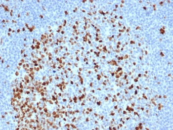 Recombinant Topoisomerase II alpha Antibody / TOP2A