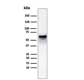 Recombinant HSPD1 Antibody / HSP60