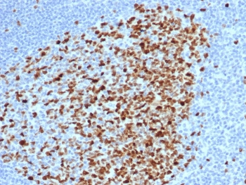 Recombinant TOP2A Antibody / Topoisomerase II alpha