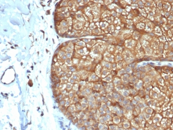 Recombinant Acidic Cytokeratin Antibody (LMW / Type I)