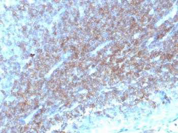 CD48 Antibody (Pan Leukocyte Marker)