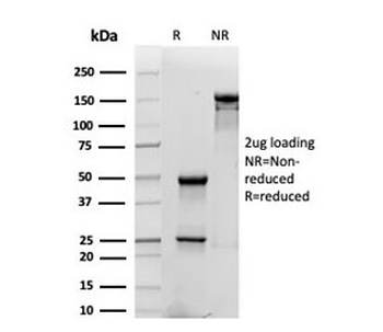 CD48 Antibody (Pan Leukocyte Marker)