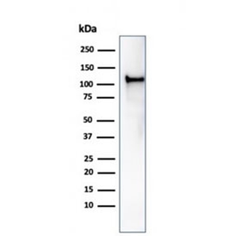Recombinant MSH2 Antibody