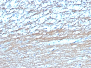 PGP9.5 / UchL1 Antibody