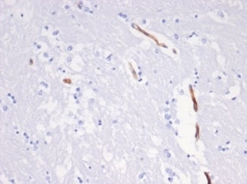 Recombinant Vimentin Antibody