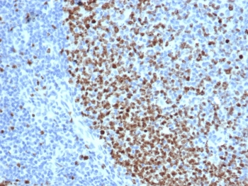 Recombinant Ki67 Antibody