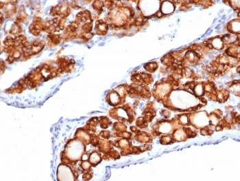 Recombinant TPO Antibody / Thyroid Peroxidase