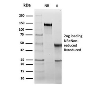 Recombinant HSP60 Antibody