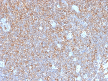 Recombinant PARVG Antibody / Gamma Parvin