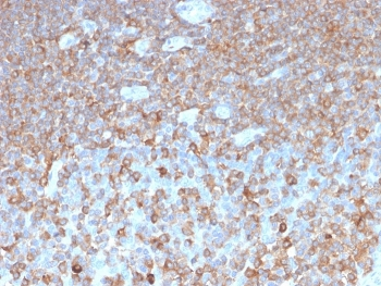 Recombinant PARVG Antibody / Gamma Parvin