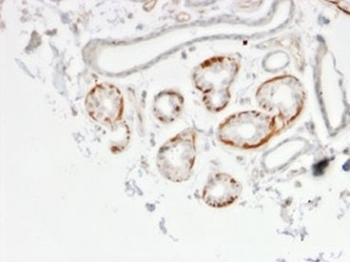 GTF2H2C Antibody