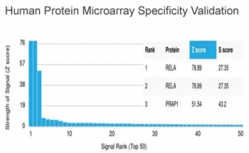 RELA Antibody / p65 NF-kB
