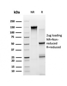 STAT5A Antibody