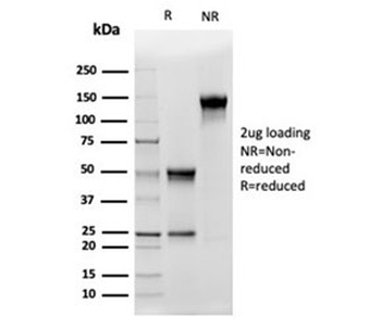 CD5 Ligand Antibody / CD5L