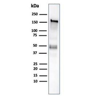 Recombinant MSH6 Antibody