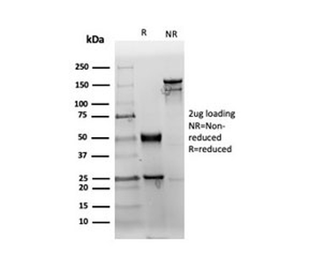 Recombinant CD38 Antibody