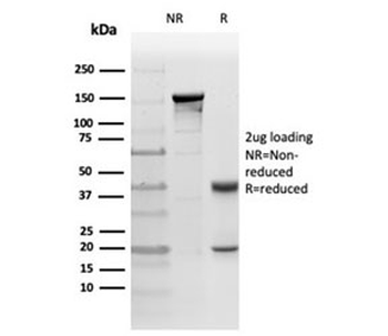 PRKCI Antibody / PKC iota