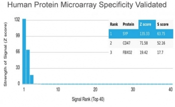 Recombinant Synaptophysin Antibody / SYP