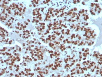 Recombinant Cyclin E1 Antibody / CCNE1