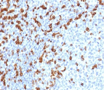 Recombinant CD7 Antibody