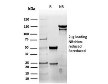 Recombinant CD7 Antibody