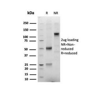 Recombinant ERG Antibody / Transcriptional regulator ERG