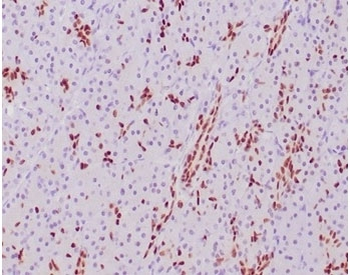 SOX9 Antibody