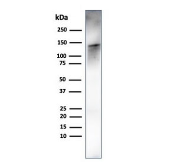 Recombinant Caldesmon Antibody / CAD / CALD1 (HMW)