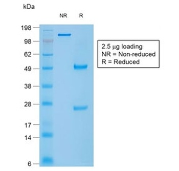 Recombinant Caldesmon Antibody / CAD / CALD1 (HMW)