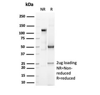 Recombinant CD6 Antibody