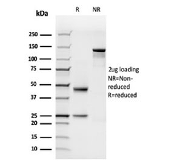Complement C1q B-Chain Antibody / C1QB