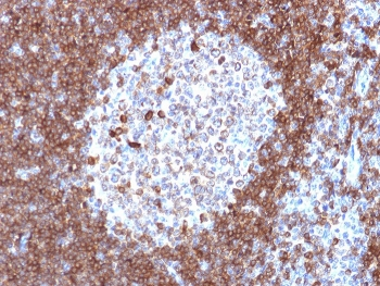 CD79a Antibody