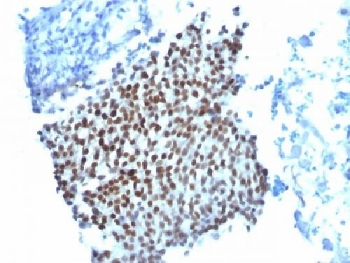 p21 Antibody