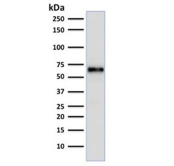 ER Antibody / Estrogen Receptor alpha
