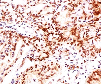 Estrogen Receptor beta Antibody