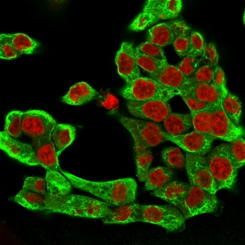 Cytokeratin 8 Antibody