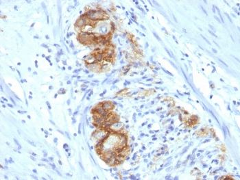 NCAM Antibody / CD56
