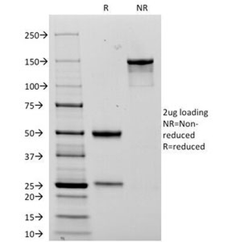 NCAM Antibody / CD56
