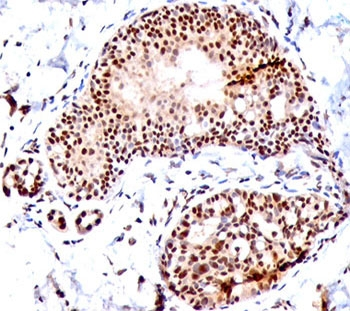 SUMO1 Antibody