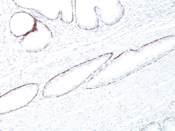 HMW Cytokeratin Antibody / Basic / Type II