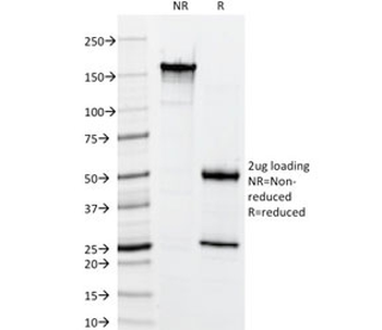 HMW Cytokeratin Antibody / Basic / Type II