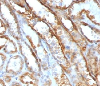 Mitochondrial Antibody