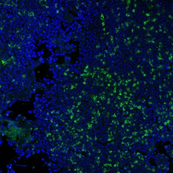 CD3 Antibody / CD3e